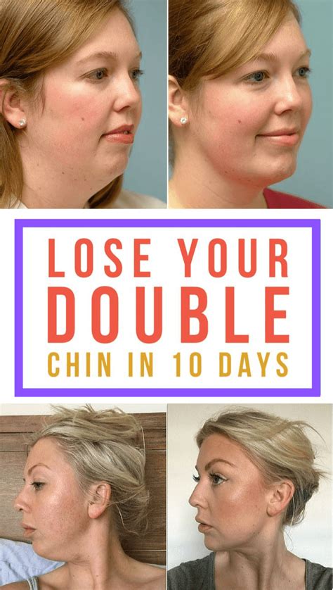 bbw chin|How to Get Rid of a Double Chin, According to a Dermatologist.